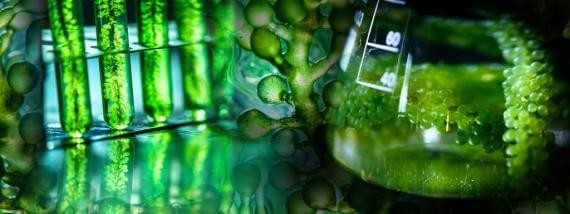 Sensors for Bioprocessing Sensors for Bioprocessing