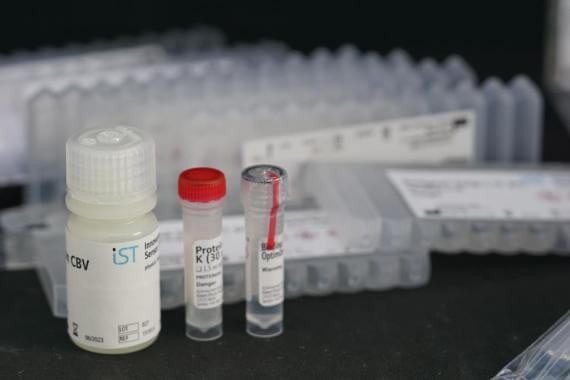 Lysis RNA extraction