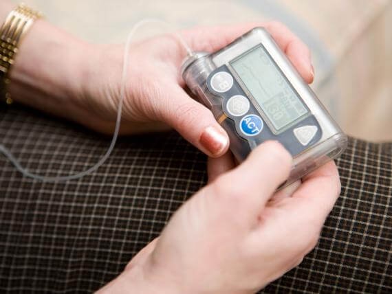 Pressure sensors for diabetes selfcare Pressure sensors for diabetes selfcare